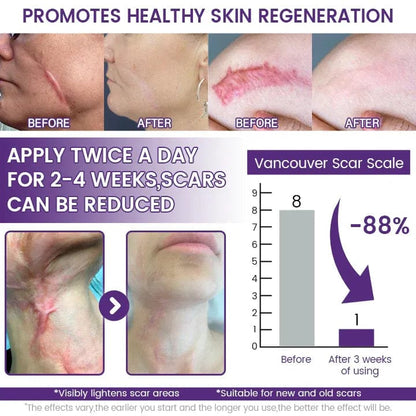 Timilk® ReGenScar Stem Cell Scar Gel
